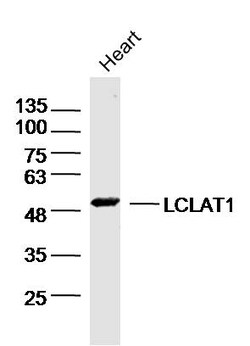 LCLAT1 Rabbit anti-Human, Polyclonal, Bioss 100 &mu;L; Unconjugated:Antibodies,