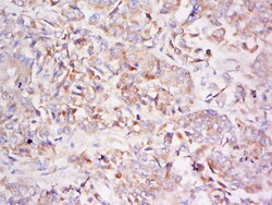LDLRAD3 Rabbit anti-Human, Polyclonal, Bioss 100 &mu;L; Unconjugated:Antibodies,