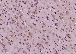 Calcitonin Rabbit anti-Human, Polyclonal, Bioss 100 &mu;L; Unconjugated:Antibodies,