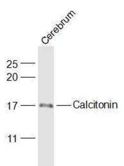 Calcitonin Rabbit anti-Human, Polyclonal, Bioss 100 &mu;L; Unconjugated:Antibodies,