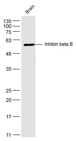Pro-Inhibin beta B Rabbit anti-Human, Polyclonal, Bioss 100 &mu;L | Buy Online | Bioss | Fisher Scientific