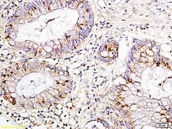 IL-15 Rabbit anti-Human, Polyclonal, Bioss 100 &mu;L; Unconjugated:Antibodies,