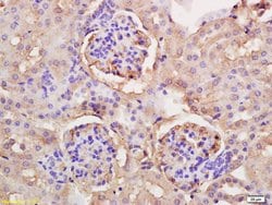 PGC1 alpha + beta Rabbit anti-Human Mouse Rat, Polyclonal, Bioss 100 &mu;L;