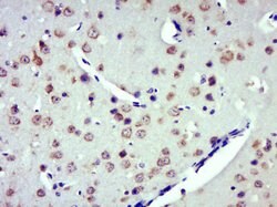 ZDHHC8 Rabbit anti-Human, Polyclonal, Bioss 100 &mu;L; Unconjugated:Antibodies,