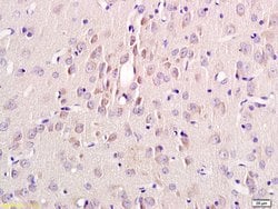alpha MSH Rabbit anti-Human, Polyclonal, Bioss 100 &mu;L; Unconjugated:Antibodies,