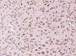 NR3C2/Mineralocorticoid receptor Rabbit anti-Human, Polyclonal, Bioss 100