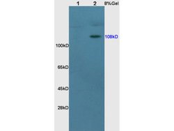 NR3C2/Mineralocorticoid receptor Rabbit anti-Human, Polyclonal, Bioss 100