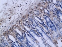 MMP-12 Rabbit anti-Human, Polyclonal, Bioss 100 &mu;L; Unconjugated:Antibodies,