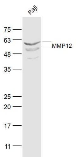MMP-12 Rabbit anti-Human, Polyclonal, Bioss 100 &mu;L; Unconjugated:Antibodies,