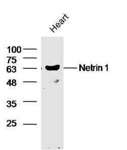 Ntn1/Netrin 1 Rabbit anti-Human, Polyclonal, Bioss 100 &mu;L; Unconjugated:Antibodies,