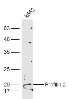 Profilin 2 Rabbit anti-Human, Polyclonal, Bioss 100 &mu;L; Unconjugated:Antibodies,