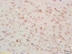 PSAP/PAP Rabbit anti-Human, Polyclonal, Bioss 100 &mu;L | Buy Online | Bioss | Fisher Scientific