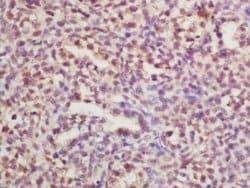 RPLP0 Rabbit anti-Human, Polyclonal, Bioss 100 &mu;L; Unconjugated:Antibodies,