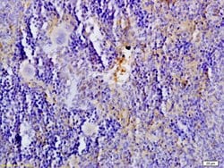 SLC6A4/5-HTT Rabbit anti-Human, Polyclonal, Bioss 100 &mu;L; Unconjugated:Antibodies,