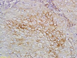 STEAP1 Rabbit anti-Human, Polyclonal, Bioss 100 &mu;L; Unconjugated:Antibodies,
