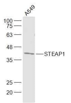 STEAP1 Rabbit anti-Human, Polyclonal, Bioss 100 &mu;L; Unconjugated:Antibodies,