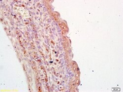 TGM3 Rabbit anti-Human, Polyclonal, Bioss 100 &mu;L; Unconjugated:Antibodies,