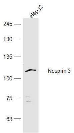 Nesprin 3 Rabbit anti-Human, Polyclonal, Bioss 100 &mu;L; Unconjugated:Antibodies,