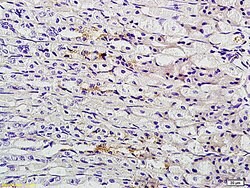 TFF2 Rabbit anti-Human, Polyclonal, Bioss 100 &mu;L; Unconjugated:Antibodies,