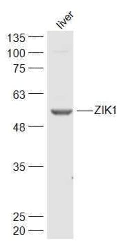 ZIK1 Rabbit anti-Human, Polyclonal, Bioss 100 &mu;L; Unconjugated:Antibodies,