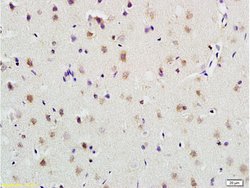 PLAUR Rabbit anti-Human, Polyclonal, Bioss 100 &mu;L; Unconjugated:Antibodies,