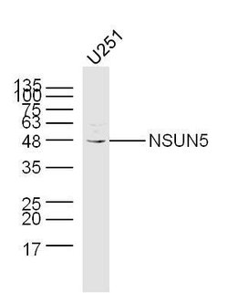 NSUN5 Rabbit anti-Human, Polyclonal, Bioss 100 &mu;L; Unconjugated:Antibodies,