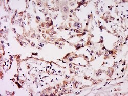 NSUN6 Rabbit anti-Human, Polyclonal, Bioss 100 &mu;L; Unconjugated:Antibodies,