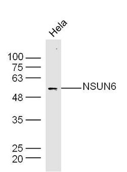 NSUN6 Rabbit anti-Human, Polyclonal, Bioss 100 &mu;L; Unconjugated:Antibodies,