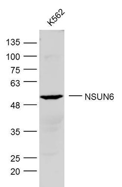 NSUN6 Rabbit anti-Human, Polyclonal, Bioss 100 &mu;L; Unconjugated:Antibodies,
