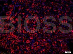 VPS18 Rabbit anti-Human, Polyclonal, Bioss 100 &mu;L; Unconjugated:Antibodies,