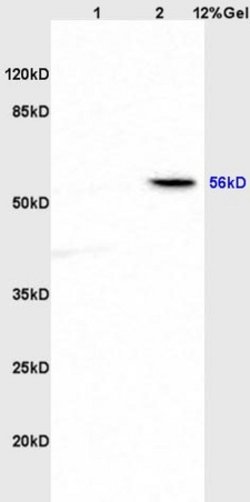 ABI1 Rabbit anti-Human, Polyclonal, Bioss 100 &mu;L; Unconjugated:Antibodies,