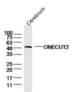 ONECUT2 Rabbit anti-Human, Polyclonal, Bioss 100 &mu;L; Unconjugated:Antibodies,