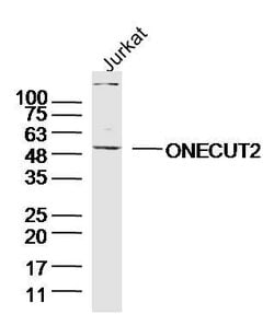 ONECUT2 Rabbit anti-Human, Polyclonal, Bioss 100 &mu;L; Unconjugated:Antibodies,