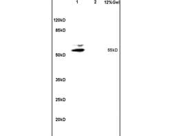 Matrilin 1 Rabbit anti-Human, Polyclonal, Bioss 100 &mu;L; Unconjugated:Antibodies,