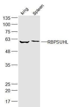 RBPSUHL Rabbit anti-Human, Polyclonal, Bioss 100 &mu;L | Buy Online | Bioss | Fisher Scientific