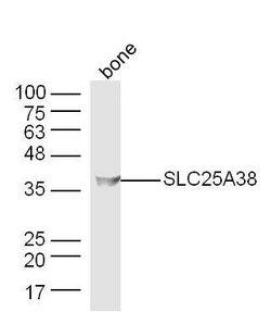 SLC25A38 Rabbit anti-Human, Polyclonal, Bioss 100 &mu;L | Buy Online | Bioss | Fisher Scientific