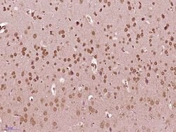 Phospho-Src (Ser75) Rabbit anti-Human, Polyclonal, Bioss 100 &mu;L; Unconjugated:Antibodies,