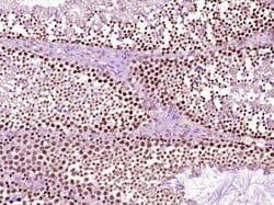 Phospho-Src (Ser75) Rabbit anti-Human, Polyclonal, Bioss 100 &mu;L; Unconjugated:Antibodies,