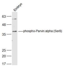 Phospho-Parvin alpha (Ser8) Rabbit anti-Human, Polyclonal, Bioss 100 &mu;L;