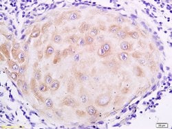 Mucin 4 Rabbit anti-Human, Polyclonal, Bioss 100 &mu;L; Unconjugated:Antibodies,