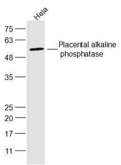 Placental Alkaline Phosphatase Rabbit anti-Human, Polyclonal, Bioss 100