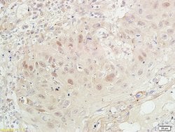 PCNA-proliferation Marker Rabbit anti-Human, Polyclonal, Bioss 100 &mu;L;