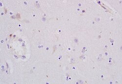 PCNA-proliferation Marker Rabbit anti-Human, Polyclonal, Bioss 100 &mu;L;