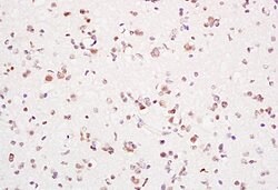 PCNA-proliferation Marker Rabbit anti-Human, Polyclonal, Bioss 100 &mu;L;