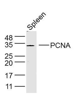 PCNA-proliferation Marker Rabbit anti-Human, Polyclonal, Bioss 100 &mu;L;