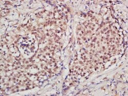 PCNA [proliferation Marker] Rabbit anti-Human, Polyclonal, Bioss 100 &mu;L;
