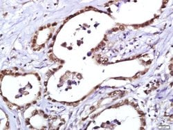 PCNA [proliferation Marker] Rabbit anti-Human, Polyclonal, Bioss 100 &mu;L;