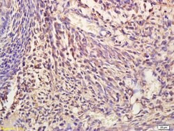 NIT2 Rabbit anti-Human, Polyclonal, Bioss 100 &mu;L; Unconjugated:Antibodies,