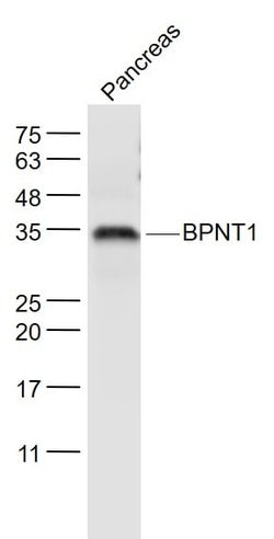 BPNT1 Rabbit anti-Human, Polyclonal, Bioss 100 &mu;L | Buy Online | Bioss | Fisher Scientific