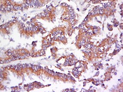 AMPK beta 1 Rabbit anti-Human, Polyclonal, Bioss 100 &mu;L; Unconjugated:Antibodies,